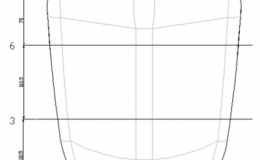 CREAFORM HandySCAN Black便攜式三維激光掃描儀在醫(yī)療頭托行業(yè)的應(yīng)用